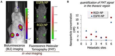 Frontiers | Advances In Lipid-based Nanocarriers For Breast Cancer ...